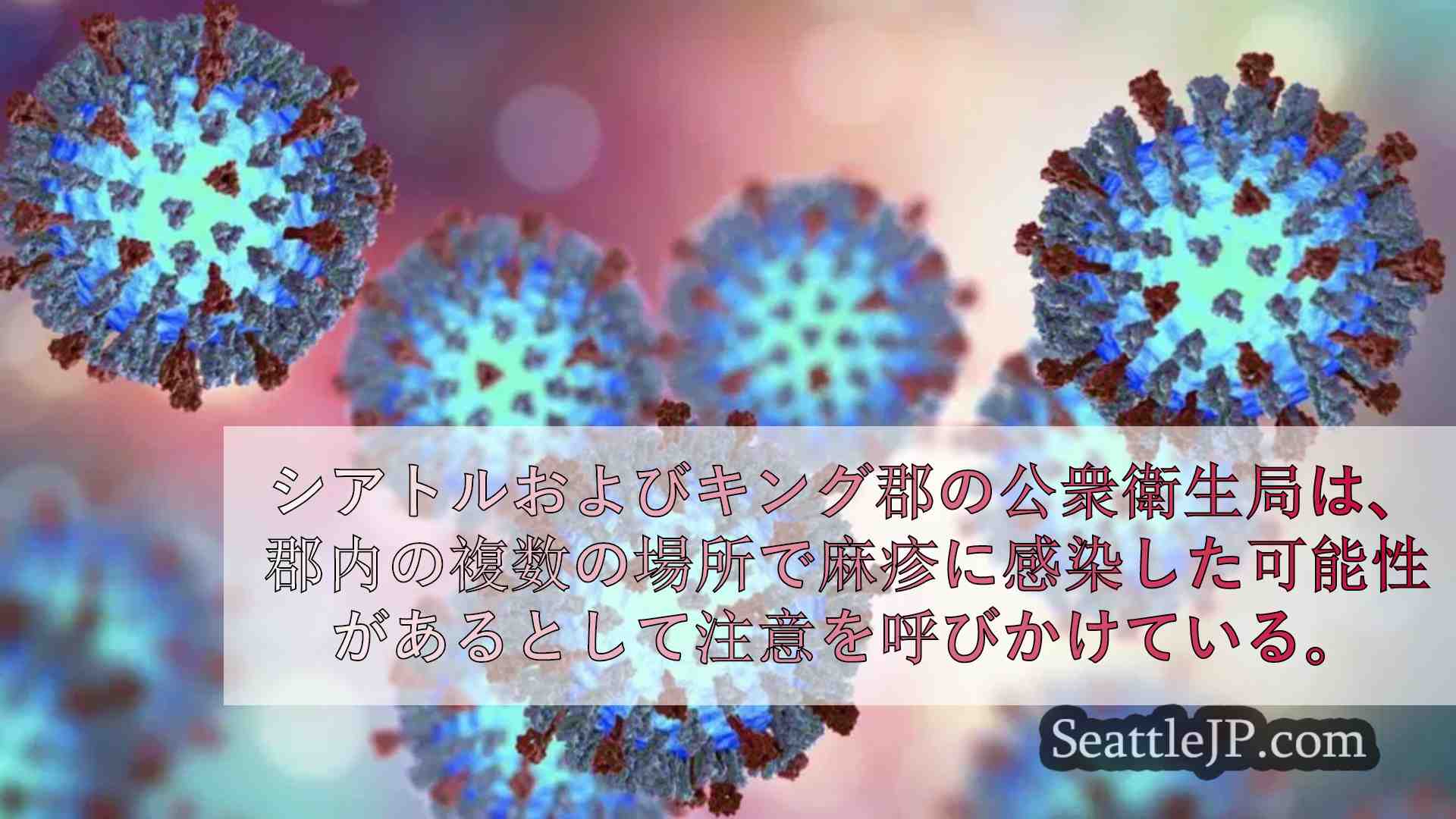 キング郡の複数の場所で麻疹に感染した可能性があるとして、保健当局が注意を呼びかけ