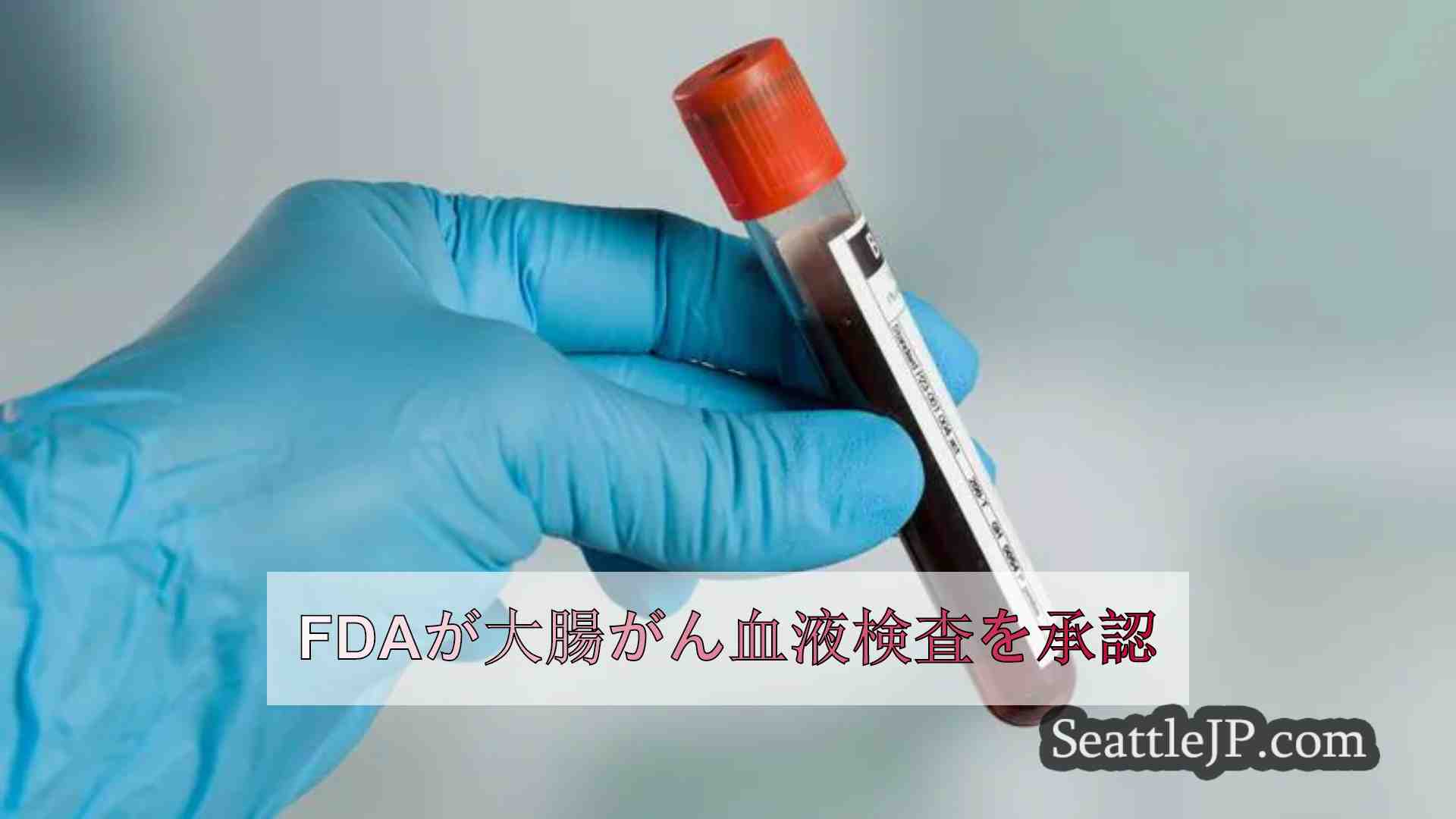FDAが大腸がん血液検査を承認