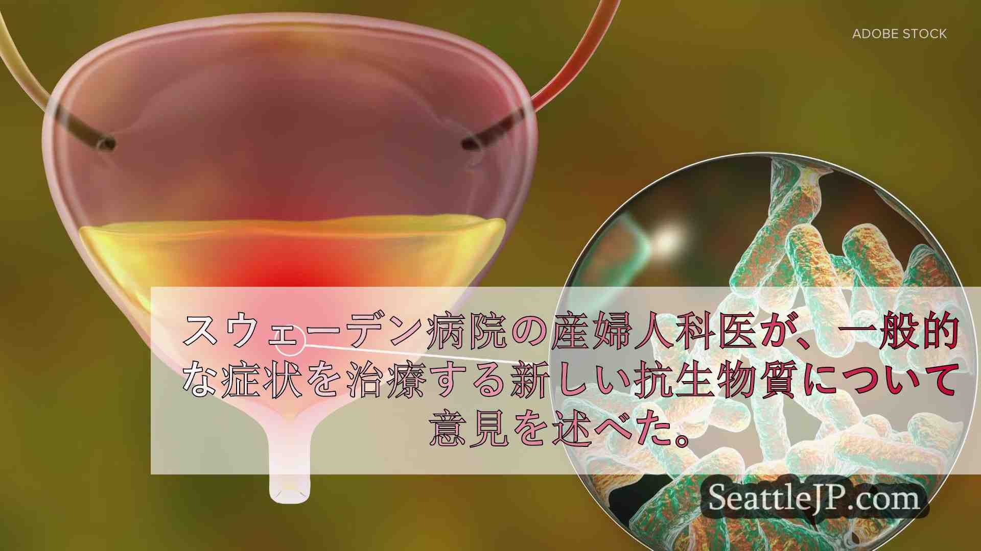 尿路感染症の治療に新しい抗生物質が米国で承認されました： ヘルスリンク