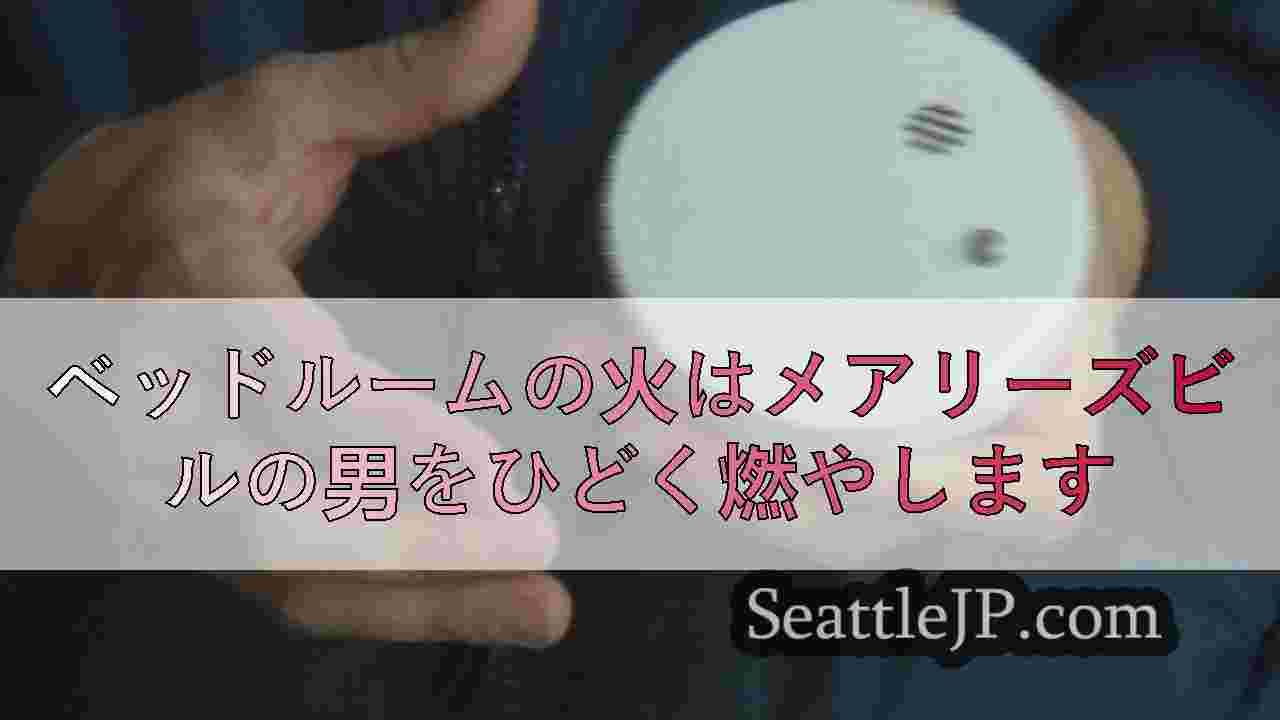 ベッドルームの火はメアリーズビルの男をひどく燃やします