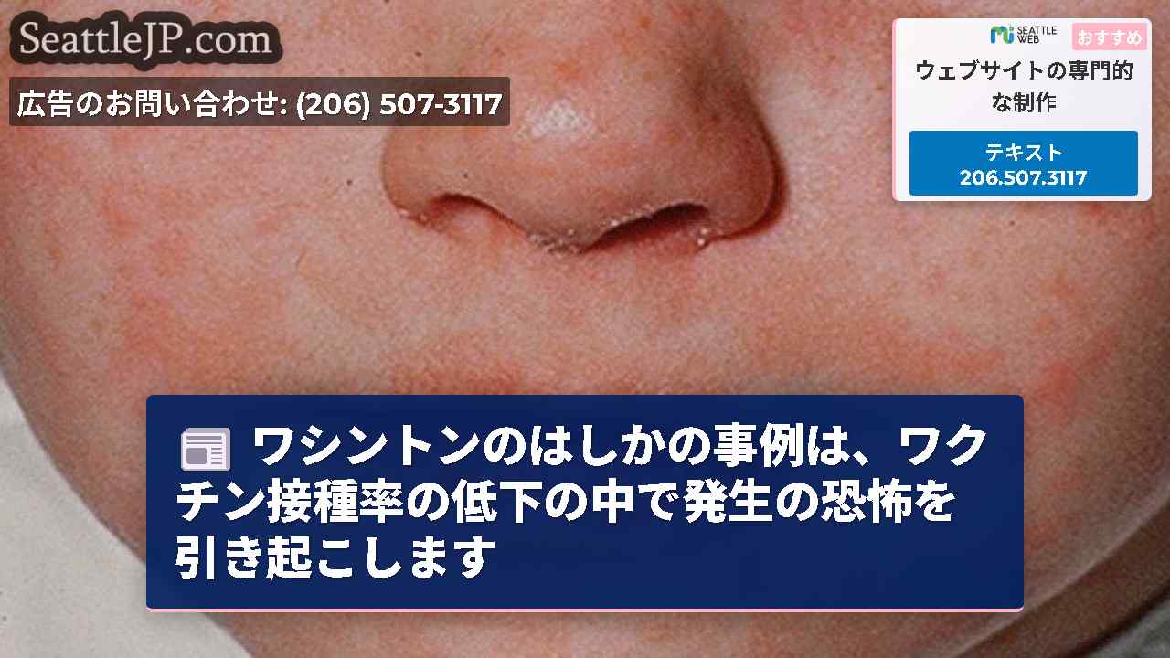 ワシントンのはしかの事例は、ワクチン接種率の低下の中で発生の恐怖を引き起こします