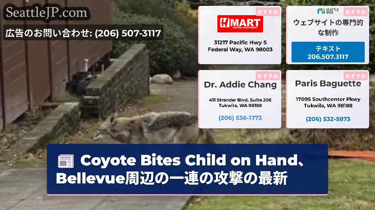 Coyote Bites Child on Hand、Bellevue周辺の一連の攻撃の最新