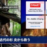 古代の杉 炎から救う