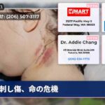 刺し傷、命の危機