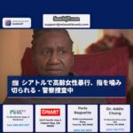 南部シアトルで高齢女性が暴行・強盗被害、指を噛み切られる – 女性「神様が私を救ってくれた」と語る