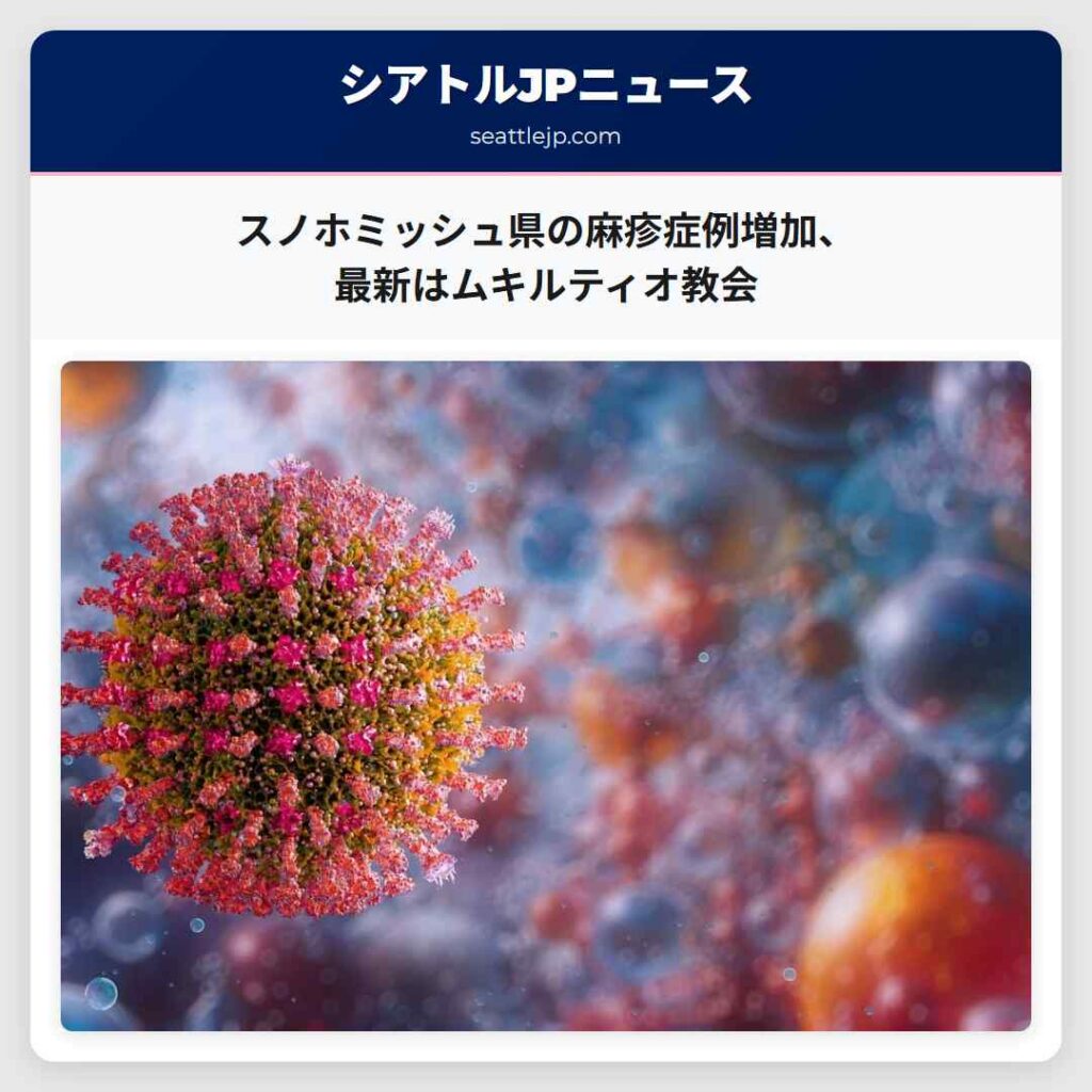 スノホミッシュ県の麻疹症例増加、最新はムキルティオ教会