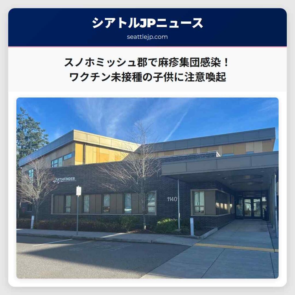 スノホミッシュ郡で麻疹集団感染！ワクチン未接種の子供に注意喚起