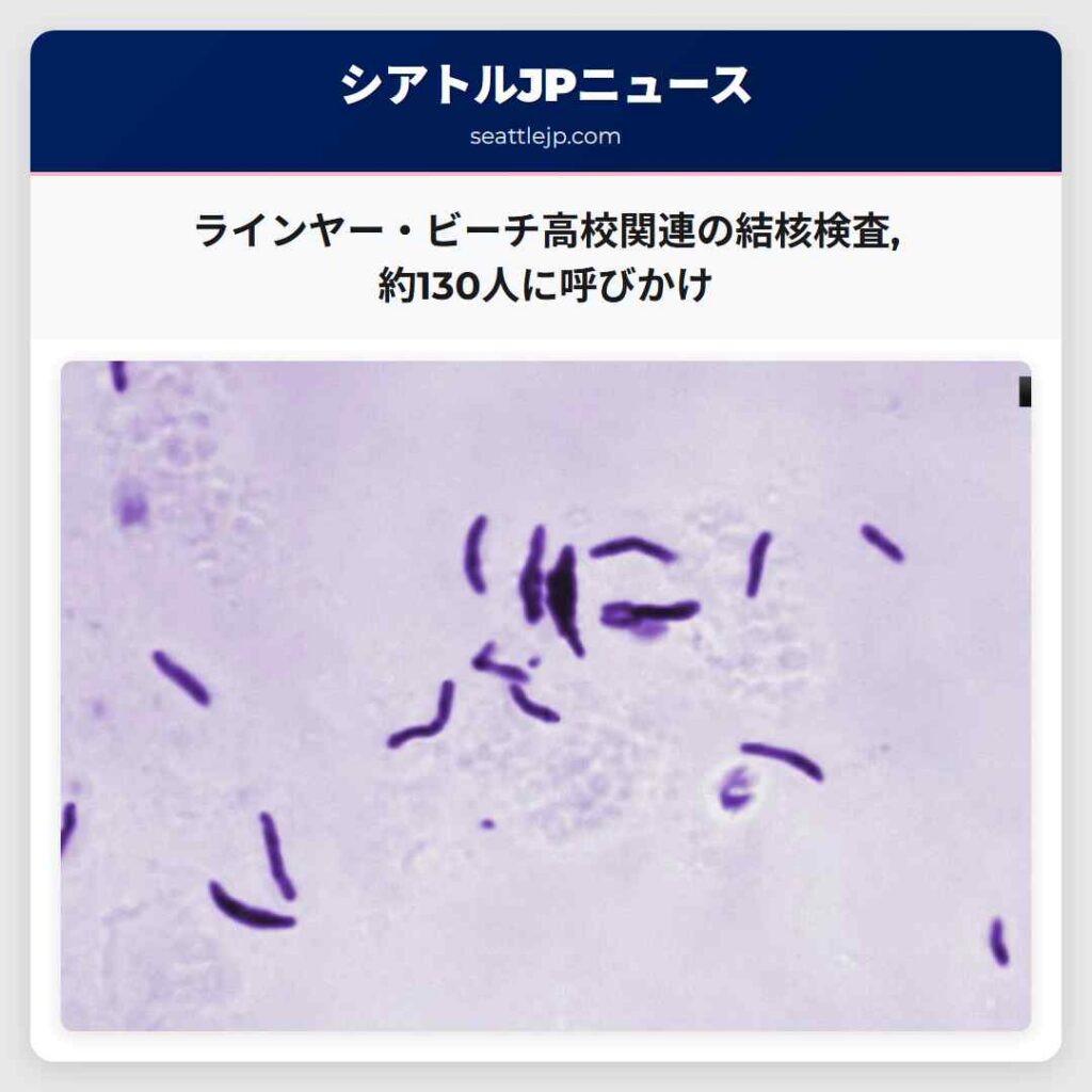 ラインヤー・ビーチ高校関連の結核検査,約130人に呼びかけ