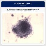 measlesに感染した乳児が公共交通機関で感染リスクをもたらした可能性