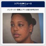 バンクーバー警察シアトル協力を呼びかけ